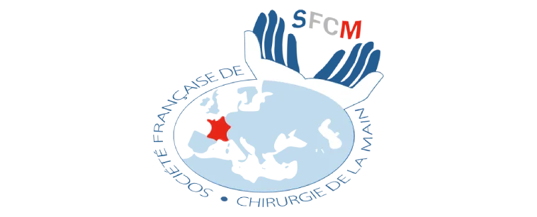 SFCM